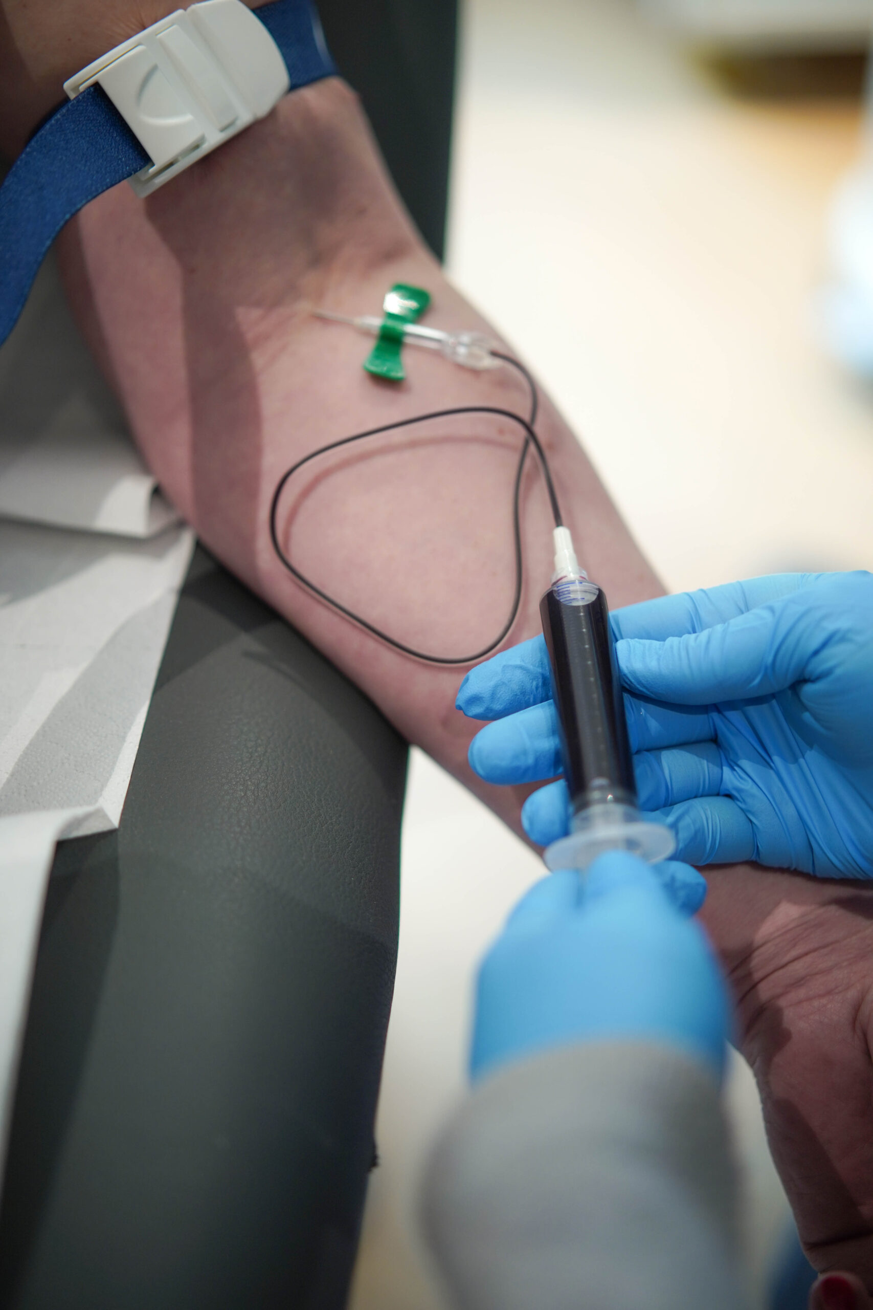 Blutentnahme für die Eigenbluttherapie/PRP